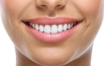 Close-up of a person smiling, showing straight, white teeth and natural lips.