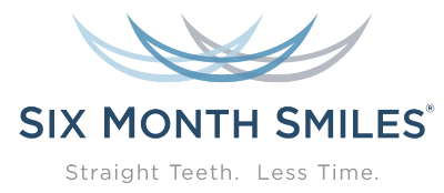 Logo featuring overlapping curved lines in blue and gray above the text "Six Month Smiles" and the tagline "Straight Teeth. Less Time.